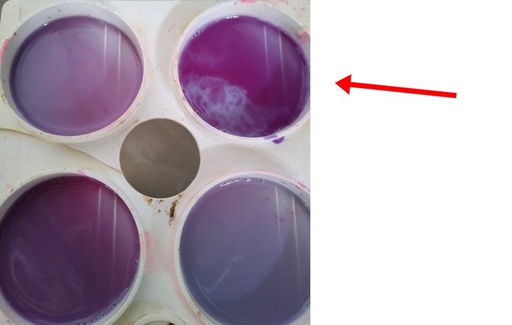 mastite subclínica mastite subclínica